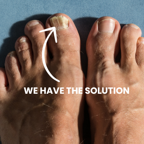 Bid Farewell to Toenail Fungus from the Comfort of Your Home