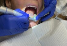 Lawmakers propose higher Medicaid reimbursement rates for NC dentists