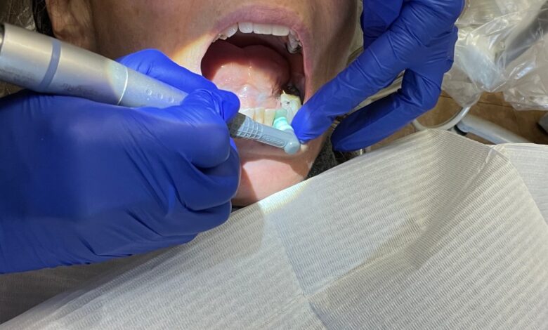 Lawmakers propose higher Medicaid reimbursement rates for NC dentists